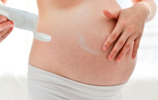 Estrías en la piel, causas y tratamientos - Dermatoclinic