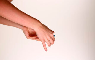 Psoriasis y claves para su tratamiento - Dermatoclinic