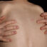 Dermatitis atópica y su cuidado integral - Dermatoclinic