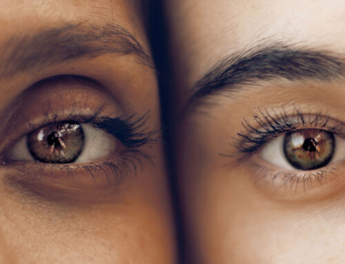 Blefaroplastia en Dermatoclinic, transforma tu mirada