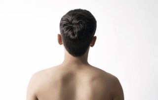 Oculoplastia, lo que necesitas saber - Dermatoclinic