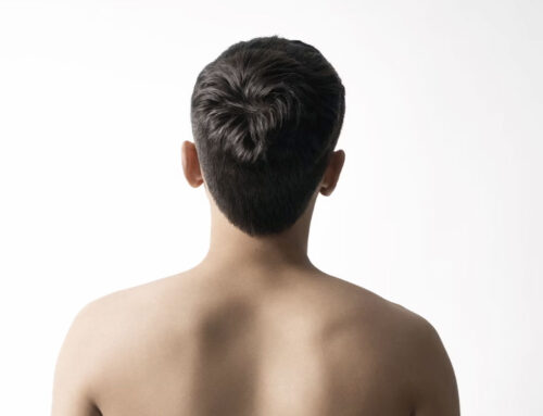 Otoplastia, lo que necesitas saber