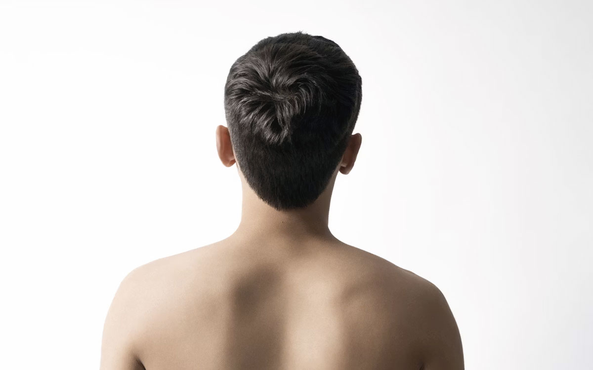 Oculoplastia, lo que necesitas saber - Dermatoclinic