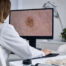 Carcinoma basocelular recurrente y cirugía de Mohs - Dermatoclinic