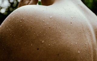 Piel durante una ola de calor - Dermatoclinic
