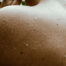 Piel durante una ola de calor - Dermatoclinic