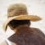 Manchas solares en verano, prevención y tratamiento - Dermatoclinic