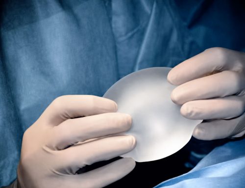 Recambio de prótesis mamarias: cuándo cambiar implantes