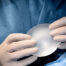 Recambio de prótesis mamarias, cuándo cambiar implantes - Dermatoclinic