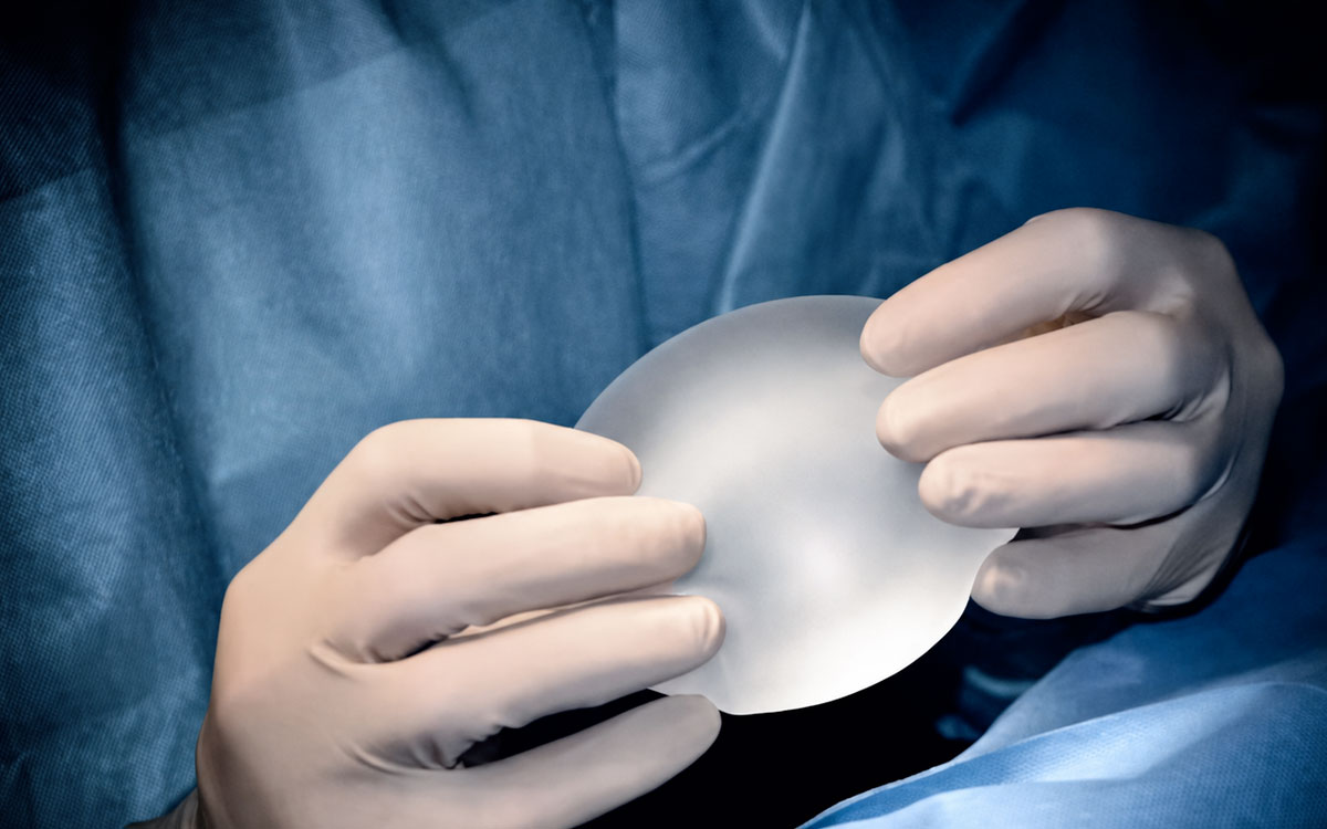 Recambio de prótesis mamarias, cuándo cambiar implantes - Dermatoclinic