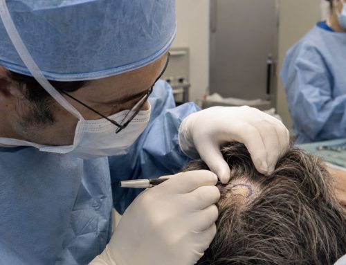 Mohs en cuero cabelludo: cirugía y reconstrucción