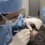 Mohs en cuero cabelludo: cirugía y reconstrucción - Dermatoclinic