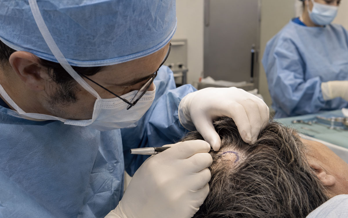 Mohs en cuero cabelludo: cirugía y reconstrucción - Dermatoclinic