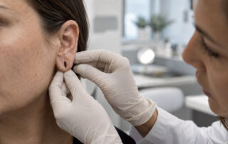 Reparación de lóbulo rasgado, cirugía y nueva perforación - Dermatoclinic